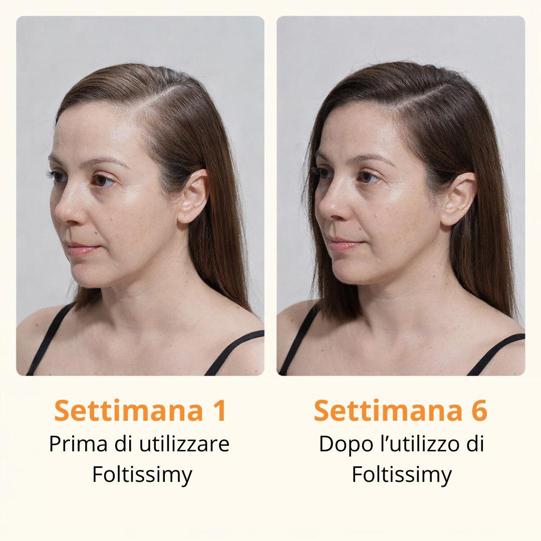 Foltissimy – Siero Cutaneo Riattivante Follicolare