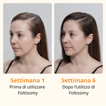 Foltissimy – Siero Cutaneo Riattivante Follicolare