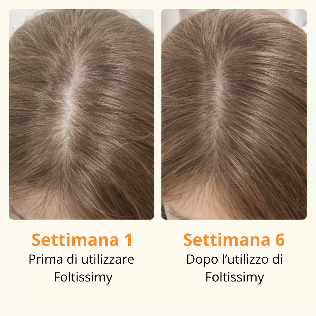 Foltissimy – Siero Cutaneo Riattivante Follicolare